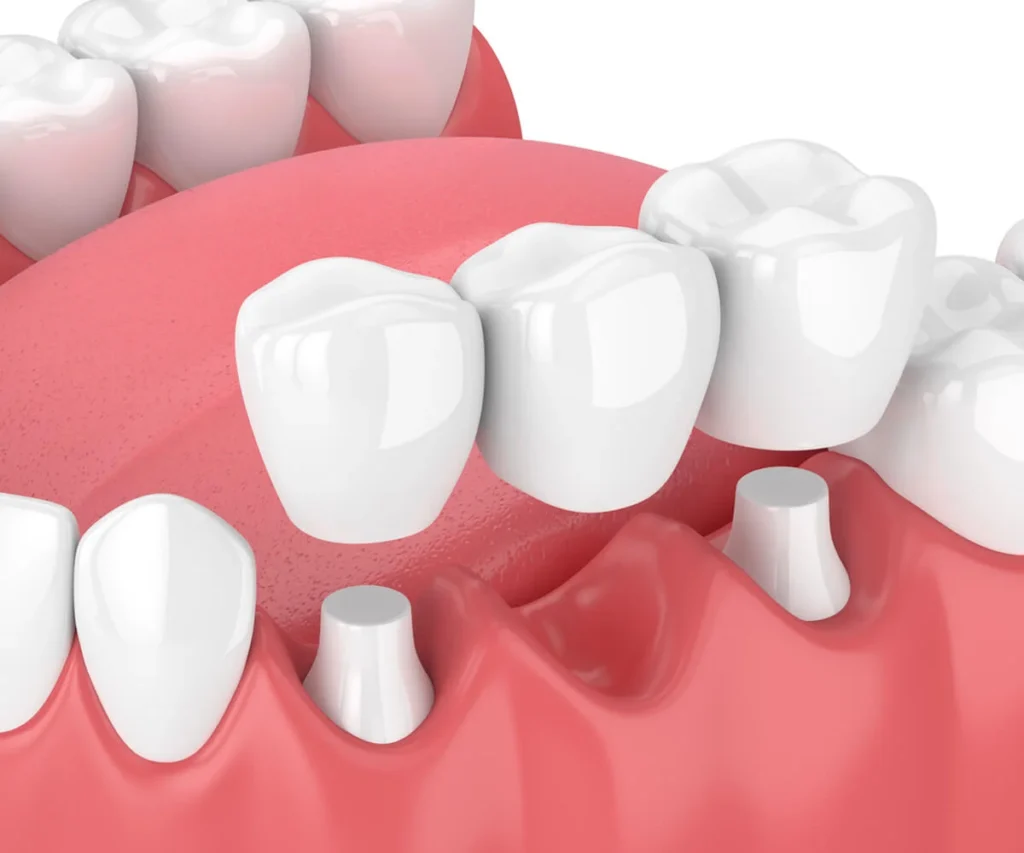 Cosmetic Dentistry Image