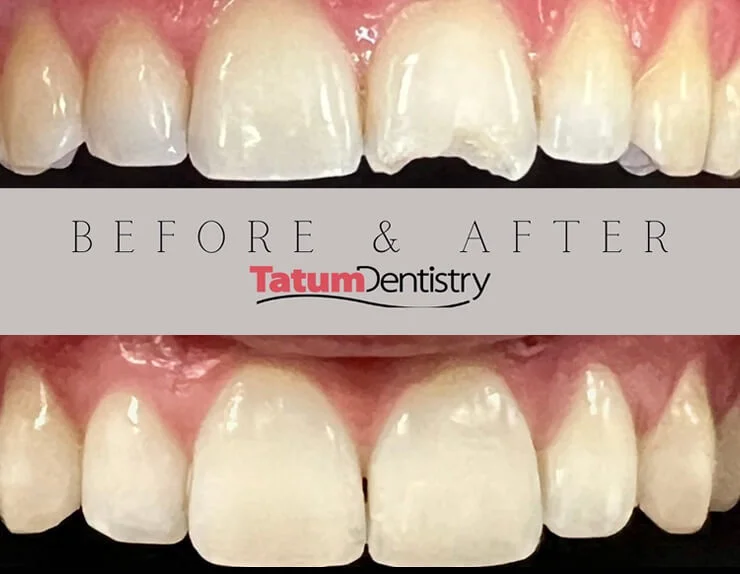 Emergency Dental Image 2